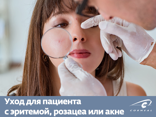 Уход для пациента с эритемой, розацеа или акне