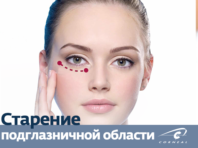 Старение подглазничной области
