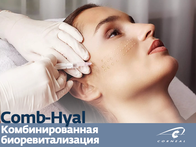 Комбинированная биоревитализация с препаратом Comb-Hyal