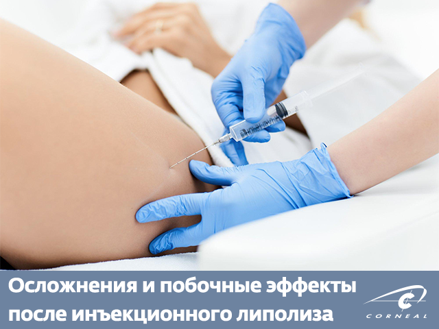 Осложнения и побочные эффекты после инъекционного липолиза