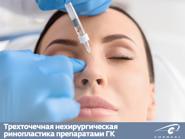 Трехточечная нехирургическая ринопластика препаратами ГК