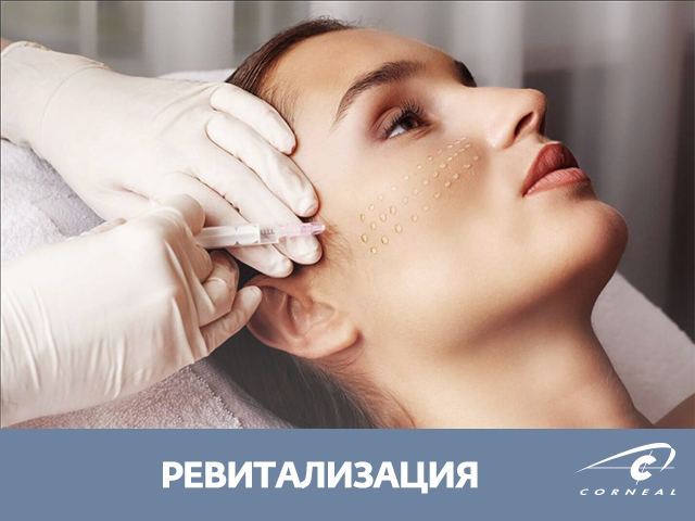 Ревитализация