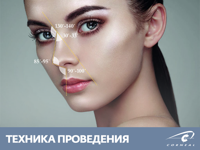 Техника проведения трехточечной нехирургической ринопластики